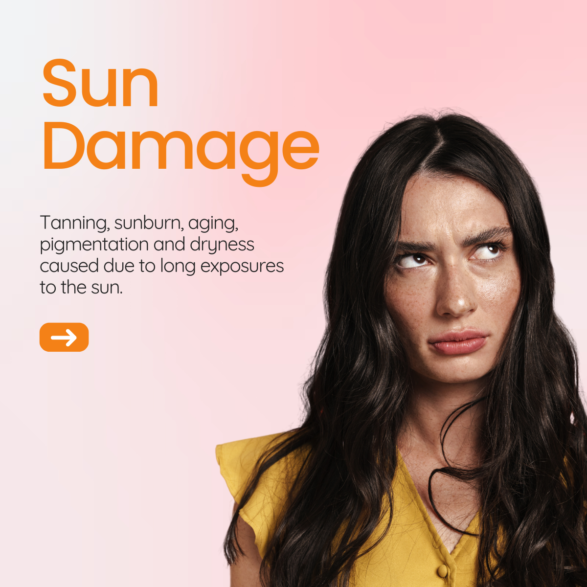 Sun Damage