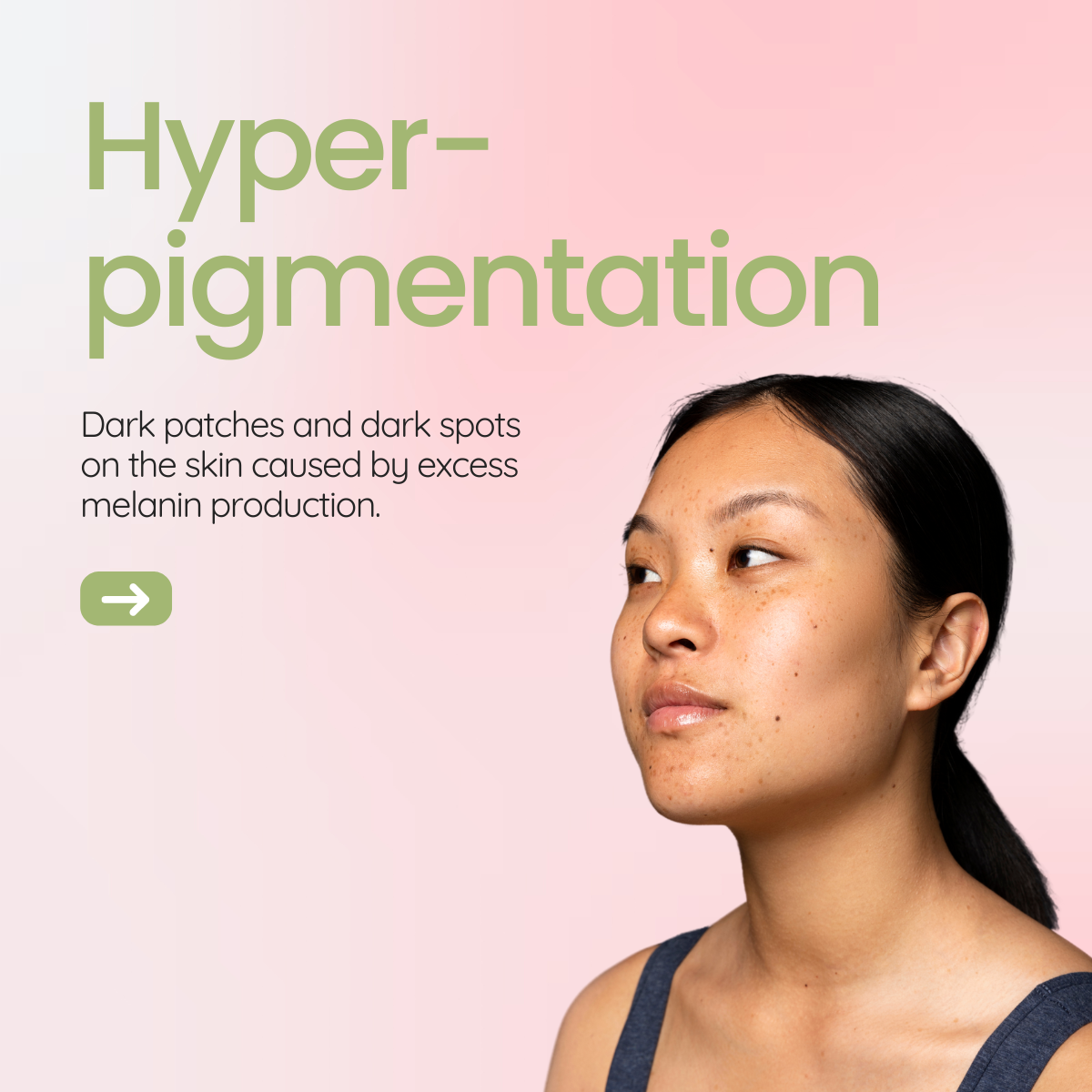 Hyper-pigmentation